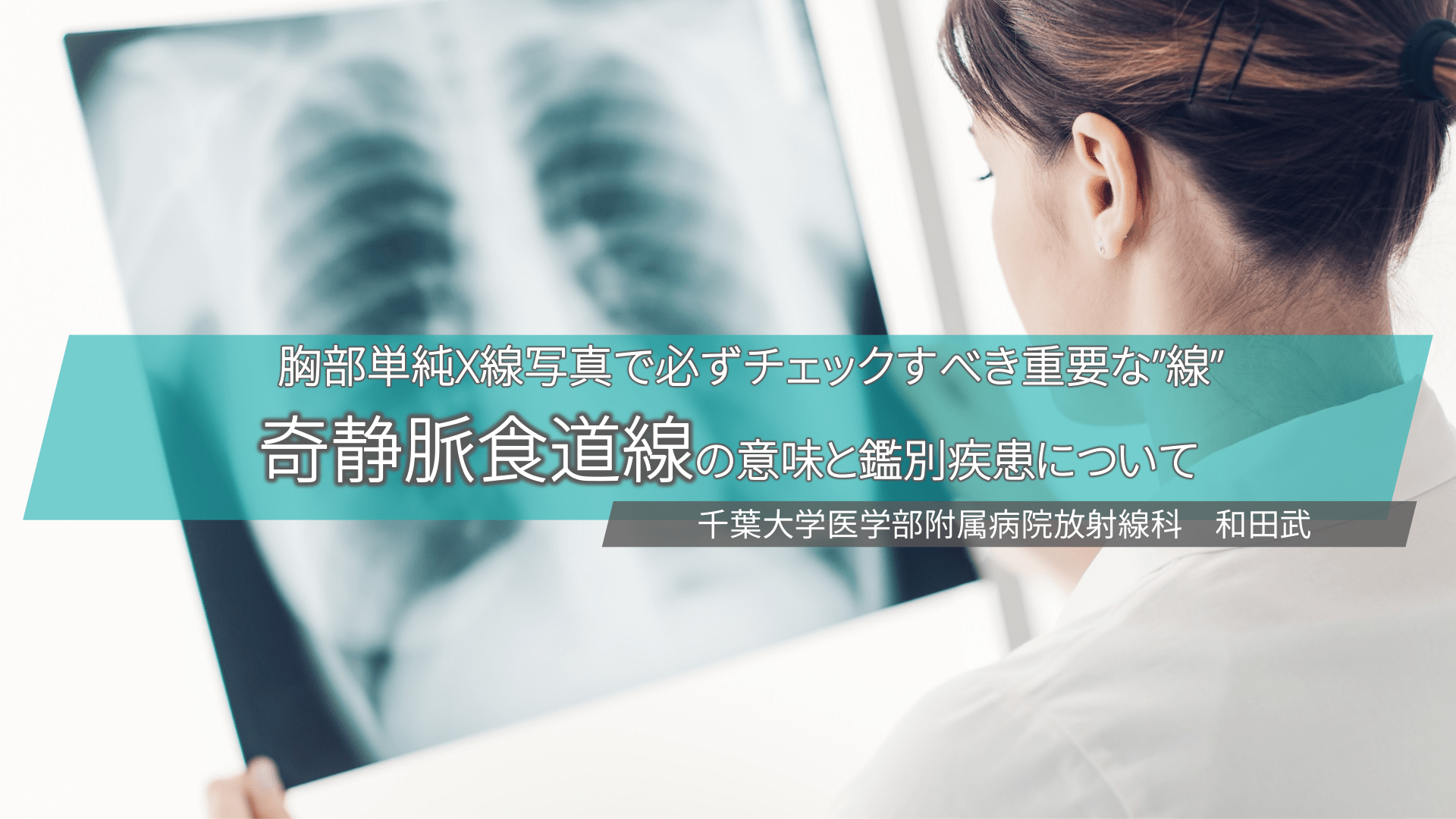 胸部単純X線写真の重要な”線”　「奇静脈食道線」の意味と鑑別疾患について L1.png