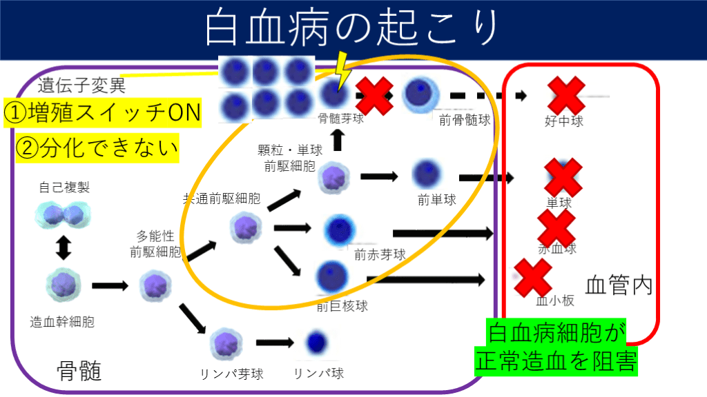 慢性骨髄性白血病の平均余命