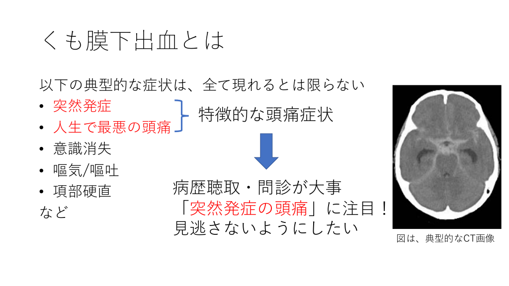 外来でくも膜下出血を疑ったときの対応 | Antaa Slide 外来でくも膜下出血を疑ったときの対応 | Antaa Slide