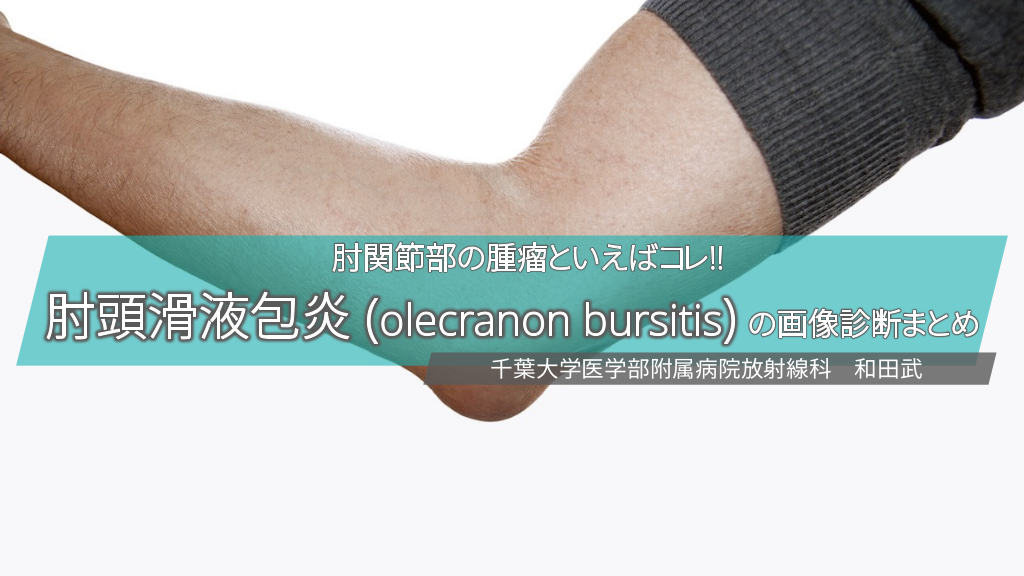 肘関節部の腫瘤といえばコレ!! 肘頭滑液包炎 (olecranon bursitis) の画像診断まとめ L1.png