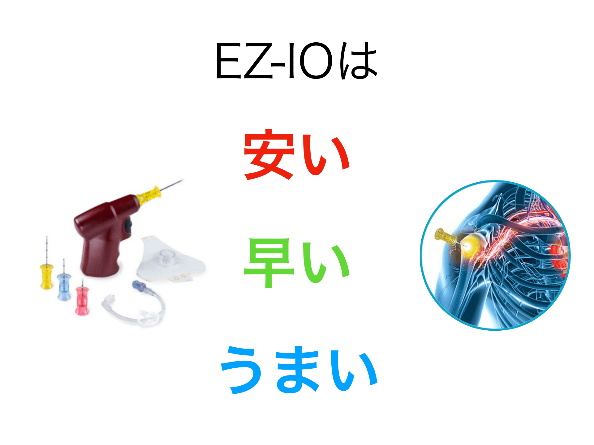 はじめてのEZ-IO(骨髄針) 安い・早い・うまい 使い方 | Antaa Slide