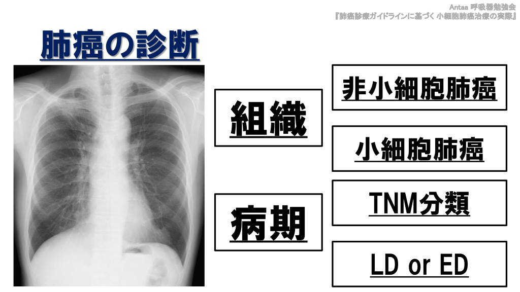 肺癌診療ガイドラインに基づく小細胞肺癌治療の実際 | Antaa Slide