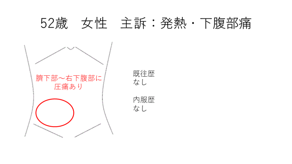 急性腹症のCT | Antaa Slide